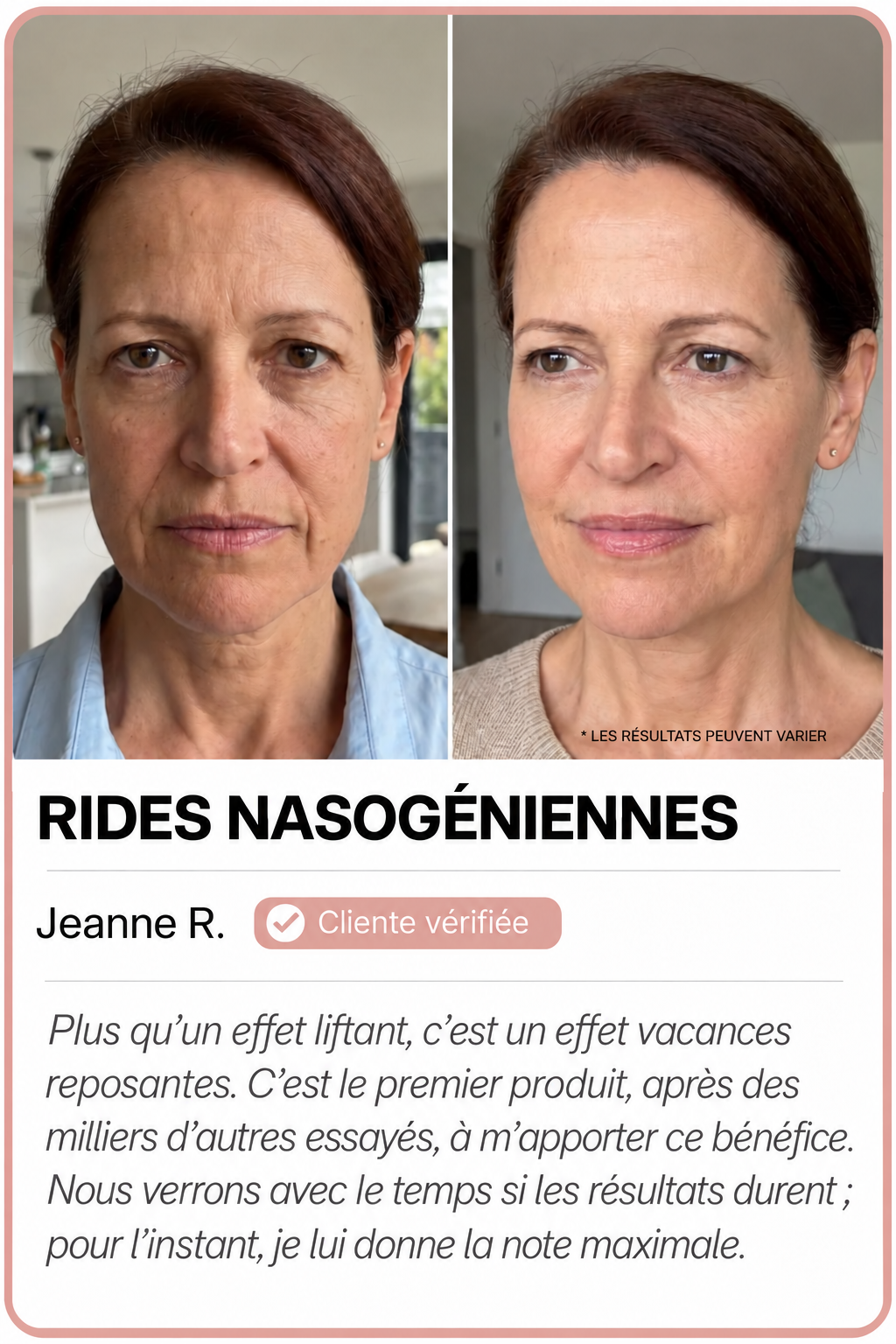 Comparaisons avant et après, image 2