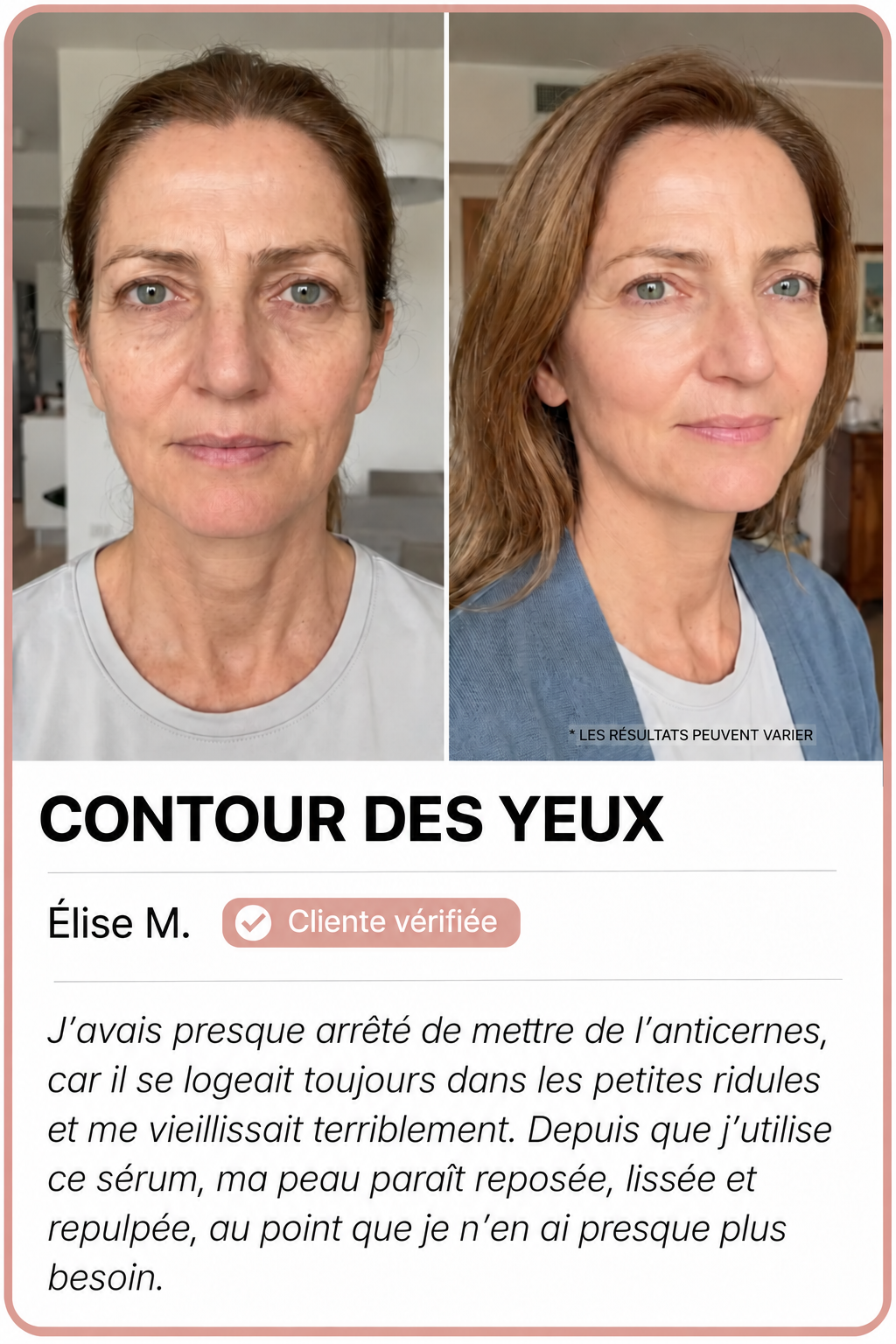 Comparaisons avant et après, image 3